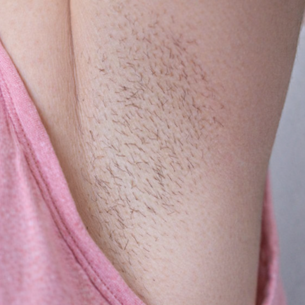 Many users begin to notice slower regrowth as early as the first few weeks. Hair may appear finer and less noticeable with consistent use.